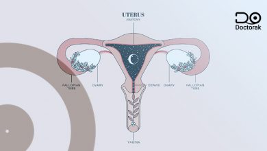 سرطان-بطانة-الرحم