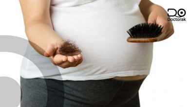 علاج تساقط الشعر اثناء الحمل