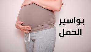 ما هي اعراض البواسير في الحمل؟