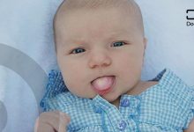 ما هو علاج فطريات اللسان عند الرضع؟
