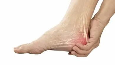 علاج ألم كعب القدم