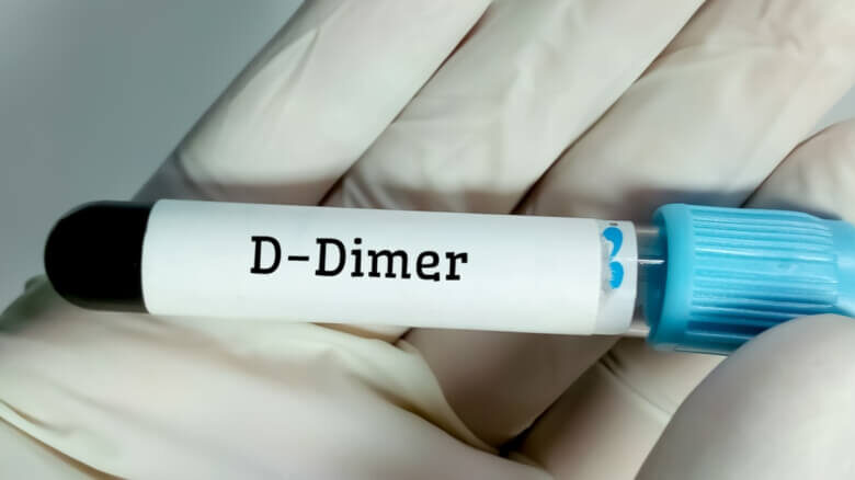 تحليل d dimer