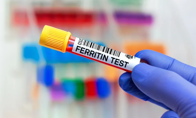 تحليل ferritin