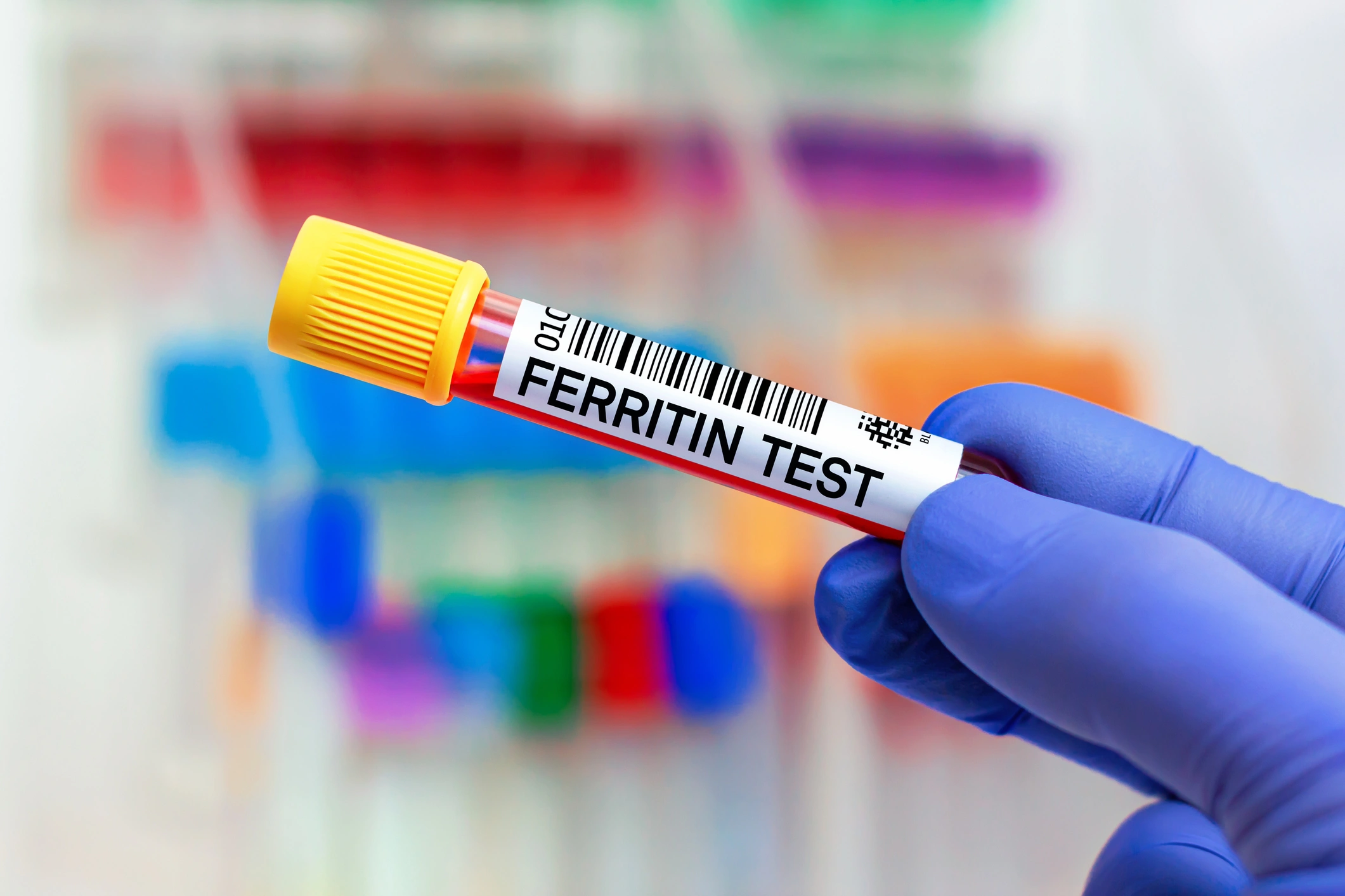 تحليل ferritin