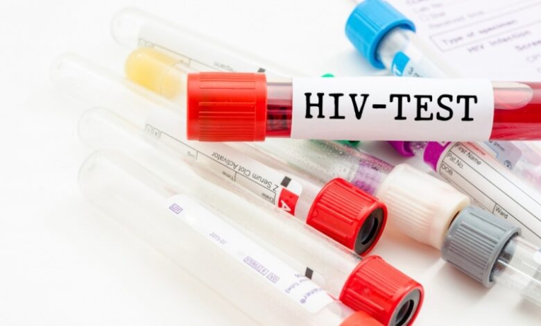 تحليل hiv 1&2