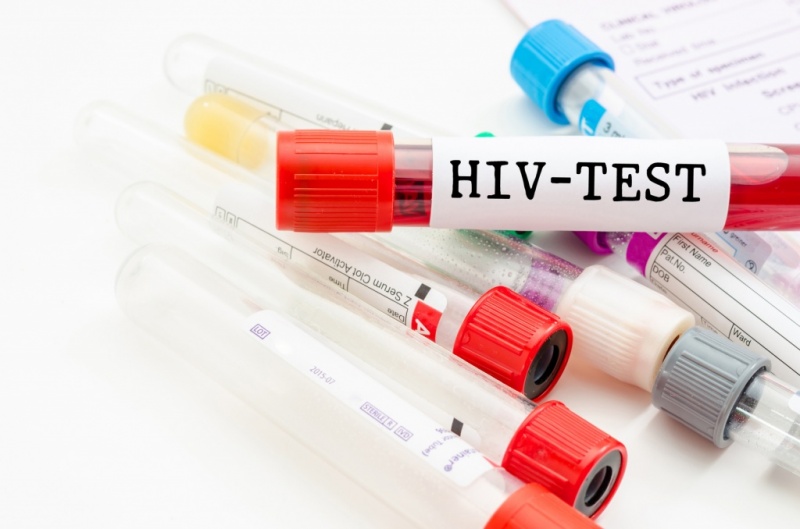 تحليل hiv 1&2