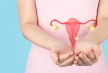 علاج تكيسات المبايض