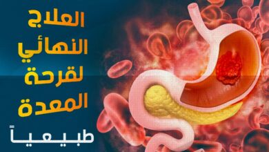علاج قرحة المعدة
