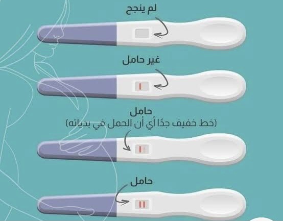 شكل اختبار الحمل السلبي