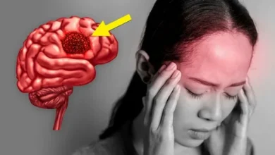 أعراض أورام المخ